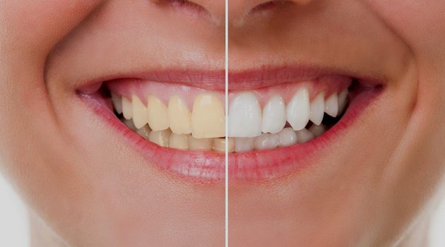 Αισθητική Οδοντιατρική